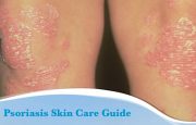 Skin Care Tips for Psoriasis