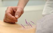Alternative Treatments for Psoriasis