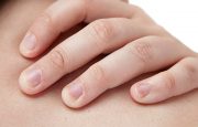 Nail Psoriasis