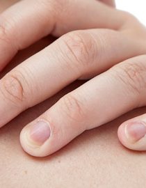 Nail Psoriasis Nail Psoriasis