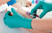 Psoriasis and Diabetes