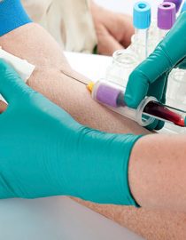 Psoriasis and Diabetes Psoriasis and Diabetes