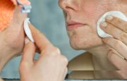 Preventing a Psoriasis Infection